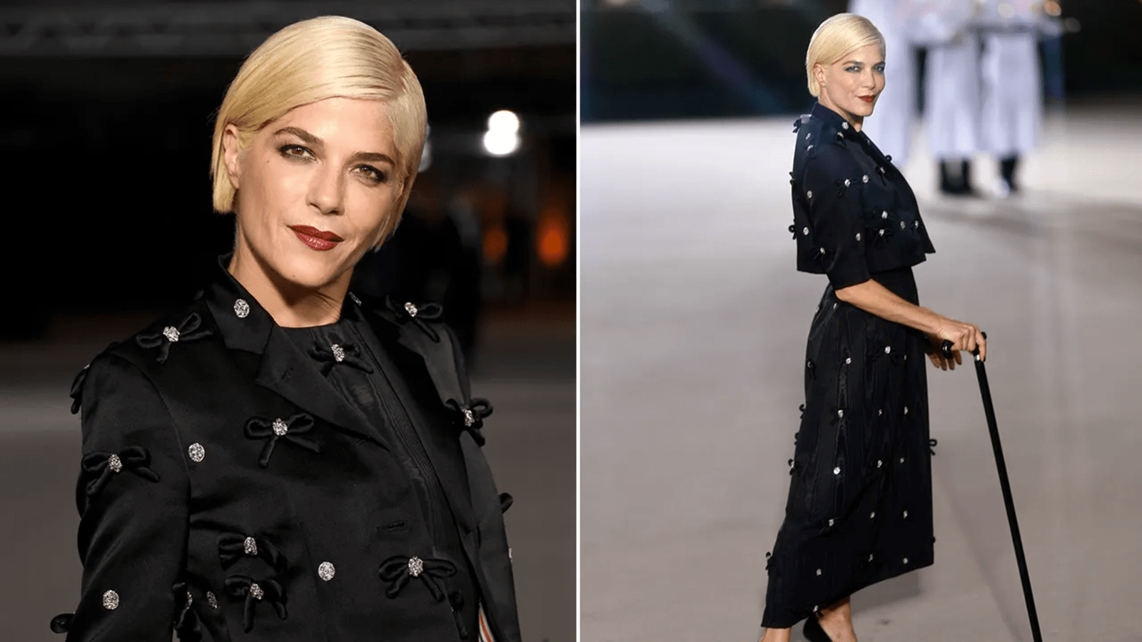 Selma Blair Opens Up About Ongoing Struggles with Multiple Sclerosis and Ehlers-Danlos Syndrome